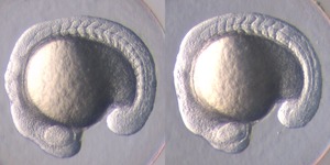 Control on left; Mutant on right; 16 hpf